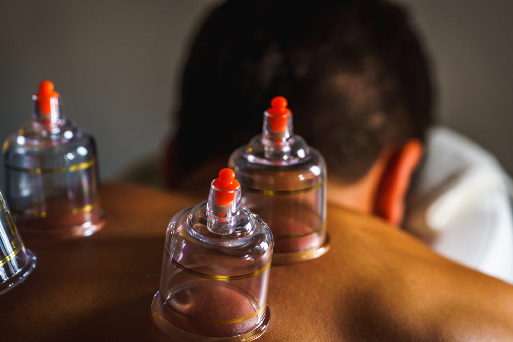 Myofascial Cupping